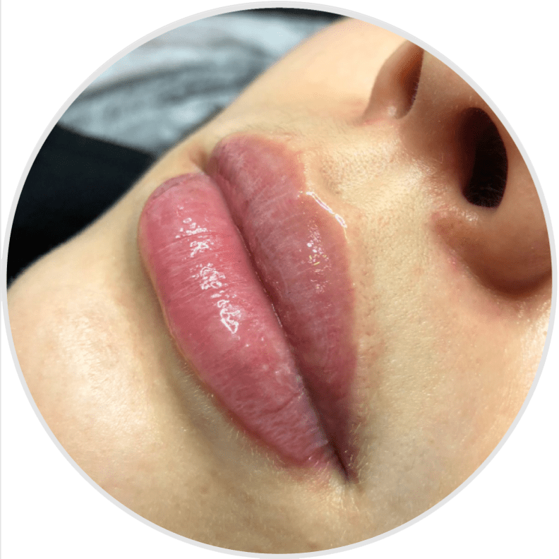 Hydra Gloss